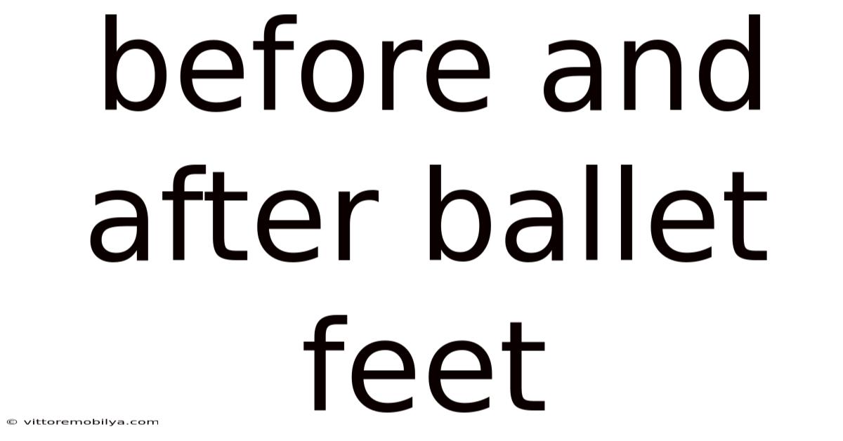 Before And After Ballet Feet