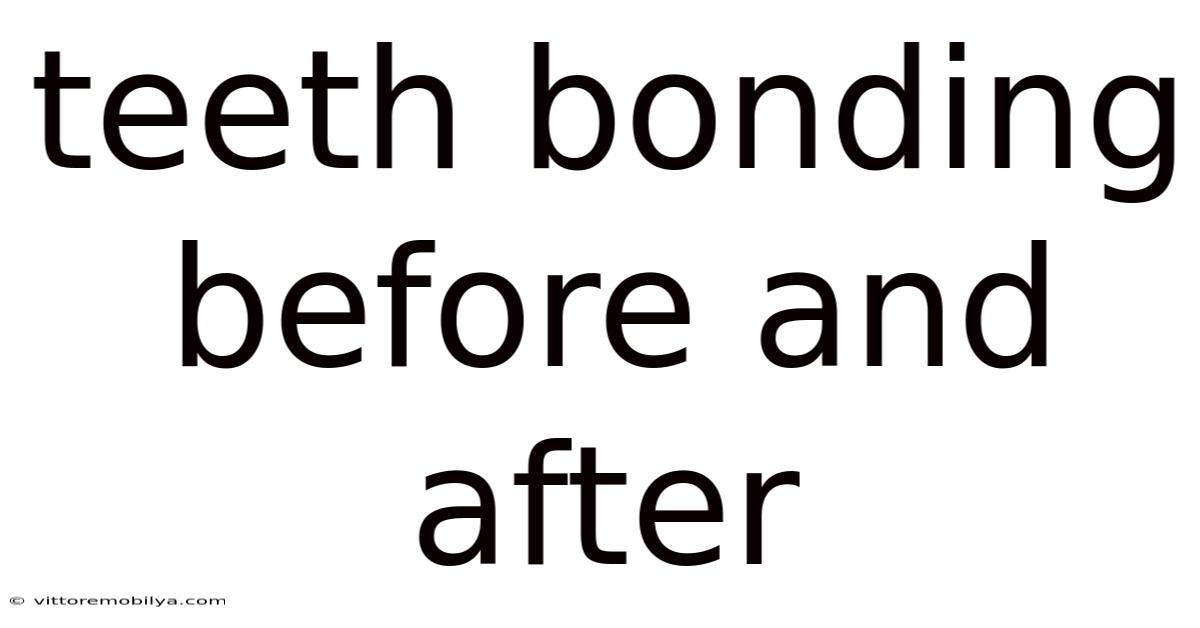 Teeth Bonding Before And After